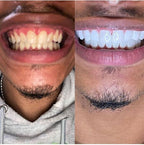 Dentifrice Blanchissant  ( Glory smille)